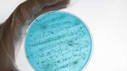 AMR petrie dish with blue goo inside